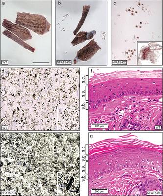 NFAT5 Controls the Integrity of Epidermis 